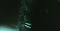 Neurochirurgia