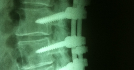 Neurochirurgia